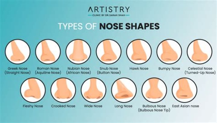 Are upturned noses rare?