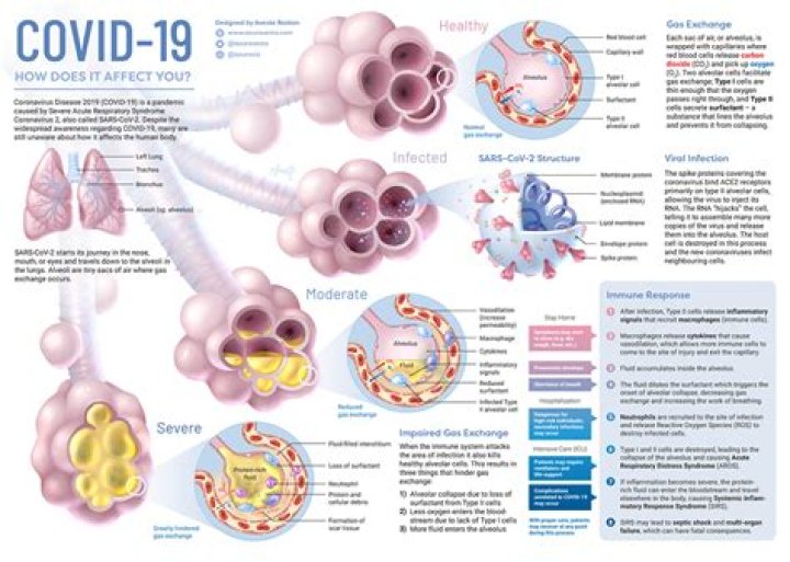 Does Covid 19 affect your pancreas?