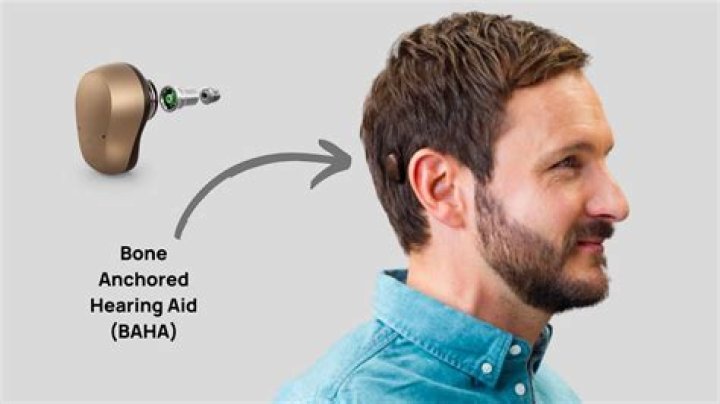 How are vision and hearing connected?