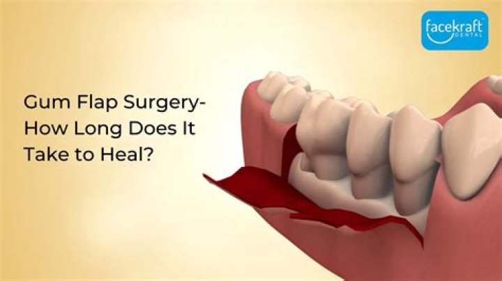 How long does pain last after gum flap surgery?