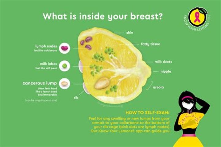 What does it feel like when your breasts are filling with milk?