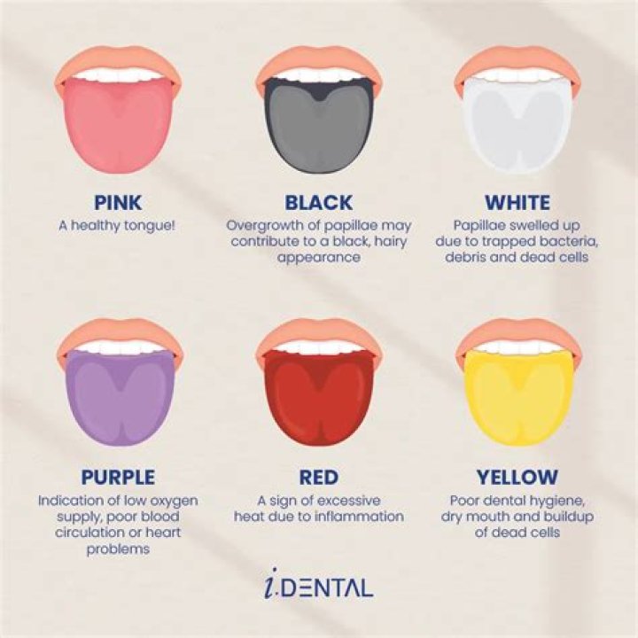 What does it mean when a dog nibbles you with his front teeth?