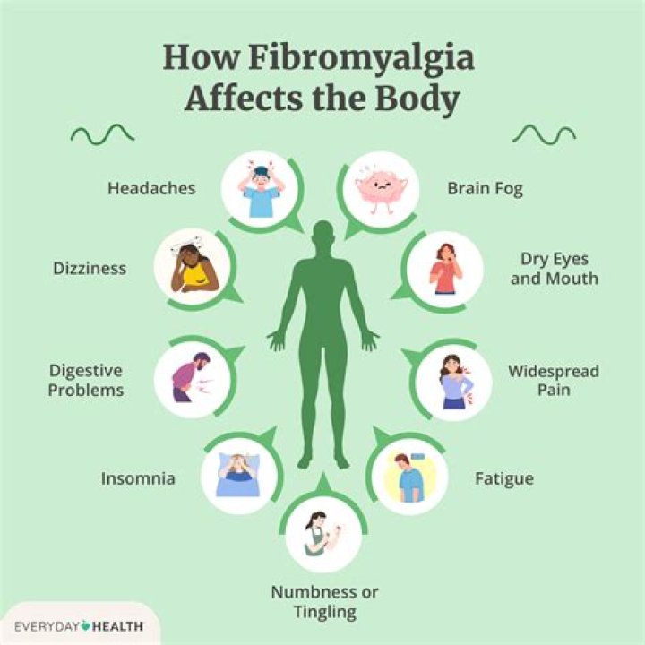 What fibromyalgia feels like?