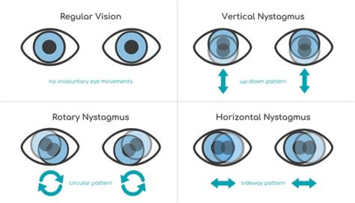 Why is SCR unidirectional?
